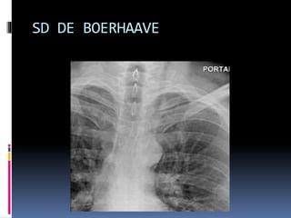 SD DE BOERHAAVE
 