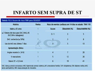 INFARTO SEM SUPRA DE ST 