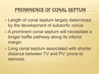 PROMINENCE OF CONAL SEPTUM
 Length of conal septum largely determined
by the development of subaortic conus
 A prominent conal septum will necissitate a
longer baffle pathway along its inferior
margin
 Long conal septum associated with shorter
distance between TV and PV: prone to
stenosis.
 