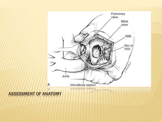 ASSESSMENT OF ANATOMY
 