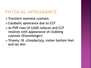  Transient neonatal cyanosis
 Catabolic apearance due to CCF
 As PVR rises LV LOAD reduces and CCF
resolves with appearance of clubbing
cyanosis (Eisenmenger)
 Trisomy 18 ,clinodactyly, rocker bottom feet
and lax skin
 