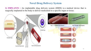 40
Novel Drug Delivery System
1) IMPLANTS : An implantable drug delivery system (IDDS) is a medical device that is
surgically implanted in the body to deliver medication to a specific organ or tissue.
 