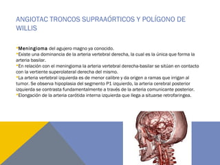 ANGIOTAC TRONCOS SUPRAAÓRTICOS Y POLÍGONO DE
WILLIS
Meningioma del agujero magno ya conocido.
Existe una dominancia de la arteria vertebral derecha, la cual es la única que forma la
arteria basilar.
En relación con el meningioma la arteria vertebral derecha-basilar se sitúan en contacto
con la vertiente superolateral derecha del mismo.
La arteria vertebral izquierda es de menor calibre y da origen a ramas que irrigan al
tumor. Se observa hipoplasia del segmento P1 izquierdo, la arteria cerebral posterior
izquierda se contrasta fundamentalmente a través de la arteria comunicante posterior.
Elongación de la arteria carótida interna izquierda que llega a situarse retrofaringea.
 