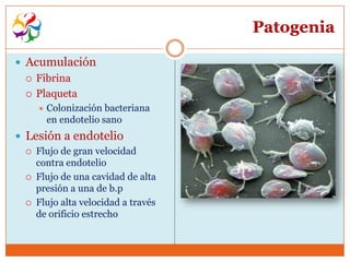 Patogenia

 Acumulación
    Fibrina
    Plaqueta
        Colonización bacteriana
         en endotelio sano
 Lesión a endotelio
    Flujo de gran velocidad
     contra endotelio
    Flujo de una cavidad de alta
     presión a una de b.p
    Flujo alta velocidad a través
     de orificio estrecho
 