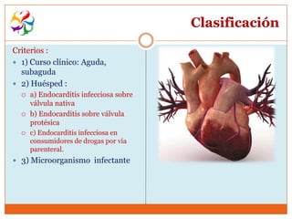 Clasificación
Criterios :
 1) Curso clínico: Aguda,
  subaguda
 2) Huésped :
     a) Endocarditis infecciosa sobre
      válvula nativa
     b) Endocarditis sobre válvula
      protésica
     c) Endocarditis infecciosa en
      consumidores de drogas por vía
      parenteral.
 3) Microorganismo infectante
 
