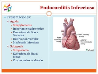 Endocarditis Infecciosa

 Presentaciones:
   Aguda
      Sthapylococcus
      Importante cuadro toxico
      Evoluciona de Días a
       Semanas
      Destrucción Valvular
      Metástasis Infecciosa
    Subaguda
      Streptococco
      Evoluciona de días a
       meses
      Cuadro toxico moderado
 