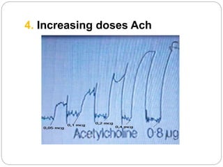 4. Increasing doses Ach
 