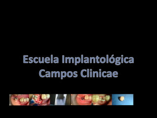 Escuela Implantológica Campos Clinicae 