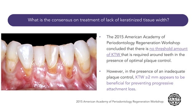 Periodontal/Peri-implant Soft tissue phenotype | PDF