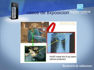 casos de exposicion
 