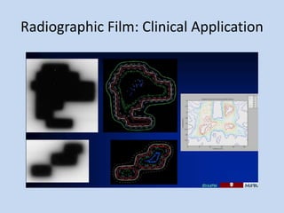 Radiographic Film: Clinical Application
 