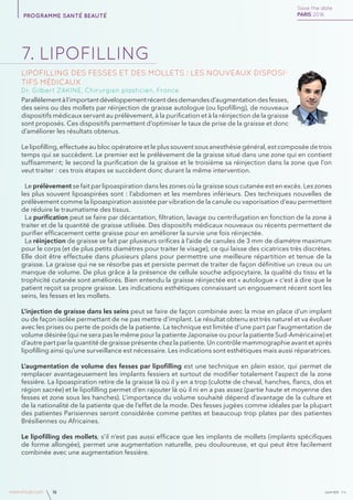 janvierAv4www.imcas.com 16
7. lipofilling
Lipofilling des fesses et des mollets : les nouveaux disposi-
tifs médicaux
Dr. Gilbert ZAKINE, Chirurgien plasticien, France
Parallèlementàl’importantdéveloppementrécentdesdemandesd’augmentationdesfesses,
des seins ou des mollets par réinjection de graisse autologue (ou lipofilling), de nouveaux
dispositifs médicaux servant au prélèvement, à la purification et à la réinjection de la graisse
sont proposés. Ces dispositifs permettent d’optimiser le taux de prise de la graisse et donc
d’améliorer les résultats obtenus.
Le lipofilling, effectuée au bloc opératoire et le plus souvent sous anesthésie général, est composée de trois
temps qui se succèdent. Le premier est le prélèvement de la graisse situé dans une zone qui en contient
suffisamment; le second la purification de la graisse et le troisième sa réinjection dans la zone que l’on
veut traiter : ces trois étapes se succèdent donc durant la même intervention.
Le prélèvement se fait par lipoaspiration dans les zones où la graisse sous cutanée est en excès. Les zones
les plus souvent lipoaspirées sont : l’abdomen et les membres inférieurs. Des techniques nouvelles de
prélèvement comme la lipoaspiration assistée par vibration de la canule ou vaporisation d’eau permettent
de réduire le traumatisme des tissus.
La purification peut se faire par décantation, filtration, lavage ou centrifugation en fonction de la zone à
traiter et de la quantité de graisse utilisée. Des dispositifs médicaux nouveaux ou récents permettent de
purifier efficacement cette graisse pour en améliorer la survie une fois réinjectée.
La réinjection de graisse se fait par plusieurs orifices à l’aide de canules de 3 mm de diamètre maximum
pour le corps (et de plus petits diamètres pour traiter le visage), ce qui laisse des cicatrices très discrètes.
Elle doit être effectuée dans plusieurs plans pour permettre une meilleure répartition et tenue de la
graisse. La graisse qui ne se résorbe pas et persiste permet de traiter de façon définitive un creux ou un
manque de volume. De plus grâce à la présence de cellule souche adipocytaire, la qualité du tissu et la
trophicité cutanée sont améliorés. Bien entendu la graisse réinjectée est « autologue » c’est à dire que le
patient reçoit sa propre graisse. Les indications esthétiques connaissant un engouement récent sont les
seins, les fesses et les mollets.
L’injection de graisse dans les seins peut se faire de façon combinée avec la mise en place d’un implant
ou de façon isolée permettant de ne pas mettre d’implant. Le résultat obtenu est très naturel et va évoluer
avec les prises ou perte de poids de la patiente. La technique est limitée d’une part par l’augmentation de
volume désirée (qui ne sera pas le même pour la patiente Japonaise ou pour la patiente Sud-Américaine) et
d’autre part par la quantité de graisse présente chez la patiente. Un contrôle mammographie avant et après
lipofilling ainsi qu’une surveillance est nécessaire. Les indications sont esthétiques mais aussi réparatrices.
L’augmentation de volume des fesses par lipofilling est une technique en plein essor, qui permet de
remplacer avantageusement les implants fessiers et surtout de modifier totalement l’aspect de la zone
fessière. La lipoaspiration retire de la graisse là où il y en a trop (culotte de cheval, hanches, flancs, dos et
région sacrée) et le lipofilling permet d’en rajouter là où il ni en a pas assez (partie haute et moyenne des
fesses et zone sous les hanches). L’importance du volume souhaité dépend d’avantage de la culture et
de la nationalité de la patiente que de l’effet de la mode. Des fesses jugées comme idéales par la plupart
des patientes Parisiennes seront considérée comme petites et beaucoup trop plates par des patientes
Brésiliennes ou Africaines.
Le lipofilling des mollets, s’il n’est pas aussi efficace que les implants de mollets (implants spécifiques
de forme allongée), permet une augmentation naturelle, peu douloureuse, et qui peut être facilement
combinée avec une augmentation fessière.
 
Save the date
PARIS 2016programme santé beauté
 