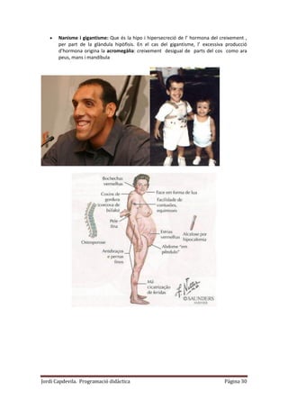 Jordi Capdevila. Programació didàctica Página 30
 Nanisme i gigantisme: Que és la hipo i hipersecreció de l’ hormona del creixement ,
per part de la glàndula hipòfisis. En el cas del gigantisme, l’ excessiva producció
d’hormona origina la acromegàlia: creixement desigual de parts del cos como ara
peus, mans i mandíbula
 