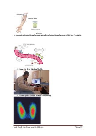 Jordi Capdevila. Programació didàctica Página 35
La gonadotropina coriònica humana, gonadotrofina coriònica humana, o hCG per l’embaràs.
4- Ecografia de la glàndula Tiroïdes
5- Gammagrafia tiroïdal (isòtops radioactius)
 