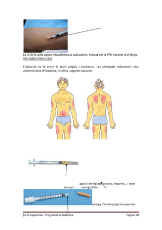 Jordi Capdevila. Programació didàctica Página 38
La ID és fa amb agulla intradèrmica o subcutània. Indicat per la PPD i proves d’al·lèrgia.
VIA SUBCUTÀNIA (SC)
L’absorció es fa entre el teixit adipós i connectiu. Les principals indicacions són:
administració d’heparina, insulina i algunes vacunes.
agulla i xeringa per insulina, heparina… ( color
taronja) xeringa d’1ml
xeringa d’insulina/ppd incorporada
 