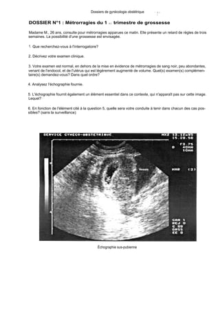 DOSSIER N°1 : Métrorragies du 1 er trimestre de grossesse
Madame M., 26 ans, consulte pour métrorragies apparues ce matin. Elle présente un retard de règles de trois
semaines. La possibilité d'une grossesse est envisagée.
1. Que recherchez-vous à l'interrogatoire?
2. Décrivez votre examen clinique.
4. Analysez l'échographie fournie.
Dossiers de gynécologie obstétrique '~ iE
1
3. Votre examen est normal, en dehors de la mise en évidence de métrorragies de sang noir, peu abondantes,
venant de l'endocol, et de l'utérus qui est légèrement augmenté de volume. Quel(s) examen(s) complémen-
taire(s) demandez-vous? Dans quel ordre?
5. L'échographie fournit également un élément essentiel dans ce contexte, qui n'apparaît pas sur cette image.
Lequel?
6. En fonction de l'élément cité à la question 5, quelle sera votre conduite à tenir dans chacun des cas pos-
sibles? (sans la surveillance)
Échographie sus-pubienne
 