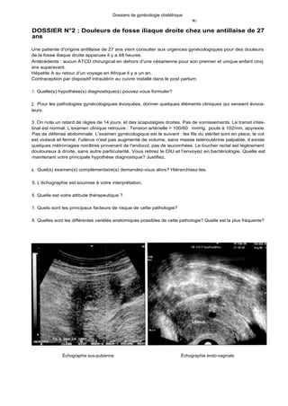 Dossiers de gynécologie obstétrique
t#J
DOSSIER N°2 : Douleurs de fosse iliaque droite chez une antillaise de 27
ans
Une patiente d'origine antillaise de 27 ans vient consulter aux urgences gynécologiques pour des douleurs
de la fosse iliaque droite apparues il y a 48 heures.
Antécédents : aucun ATCD chirurgical en dehors d'une césarienne pour son premier et unique enfant cinq
ans auparavant.
Hépatite A au retour d'un voyage en Afrique il y a un an.
Contraception par dispositif intrautérin au cuivre installé dans le post partum.
1. Quelle(s) hypothèse(s) diagnostique(s) pouvez-vous formuler?
2. Pour les pathologies gynécologiques évoquées, donner quelques éléments cliniques qui seraient évoca-
teurs.
3. On note un retard de règles de 14 jours, et des scapulalgies droites. Pas de vomissements. Le transit intes-
tinal est normal. L'examen clinique retrouve : Tension artérielle = 100/60 mmHg, pouls à 102/mn, apyrexie.
Pas de défense abdominale. L'examen gynécologique est le suivant : les fils du stérilet sont en place, le col
est violacé et fermé, l'utérus n'est pas augmenté de volume, sans masse latéroutérine palpable, il existe
quelques métrorragies noirâtres provenant de l'endocol, pas de leucorrhées. Le toucher rectal est légèrement
douloureux à droite, sans autre particularité. Vous retirez le DIU et l'envoyez en bactériologie. Quelle est
maintenant votre principale hypothèse diagnostique? Justifiez.
4. Quel(s) examen(s) complémentaire(s) demandez-vous alors? Hiérarchisez-les.
5. L'échographie est soumise à votre interprétation.
6. Quelle est votre attitude thérapeutique ?
7. Quels sont les principaux facteurs de risque de cette pathologie?
8. Quelles sont les différentes variétés anatomiques possibles de cette pathologie? Quelle est la plus fréquente?
Échographie sus-pubienne Échographie endo-vaginale
 