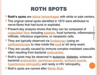 Fundoscopy For Roth's Spots Dots spots lines_and_rings_in_ophthalmology | PDF