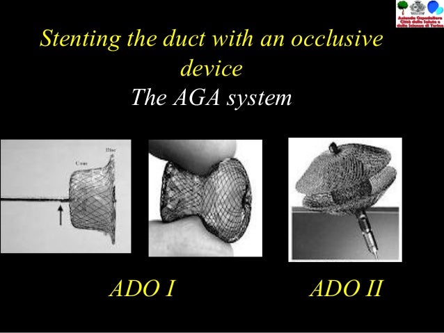 Dotto di botallo pervio