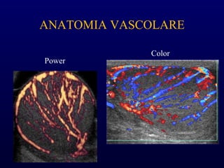 ANATOMIA VASCOLARE
Color
Power
 
