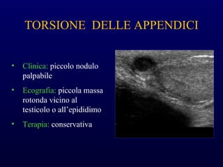 TORSIONE DELLE APPENDICI
• Clinica: piccolo nodulo
palpabile
• Ecografia: piccola massa
rotonda vicino al
testicolo o all’epididimo
• Terapia: conservativa
 