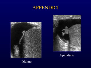 APPENDICI
Didimo
Epididimo
 