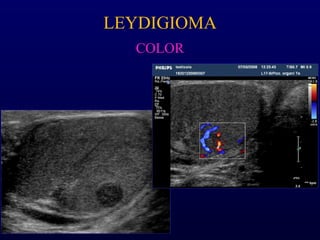 LEYDIGIOMA
COLOR
 