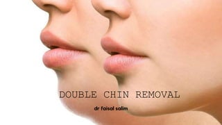 DOUBLE CHIN REMOVAL
dr faisal salim
 
