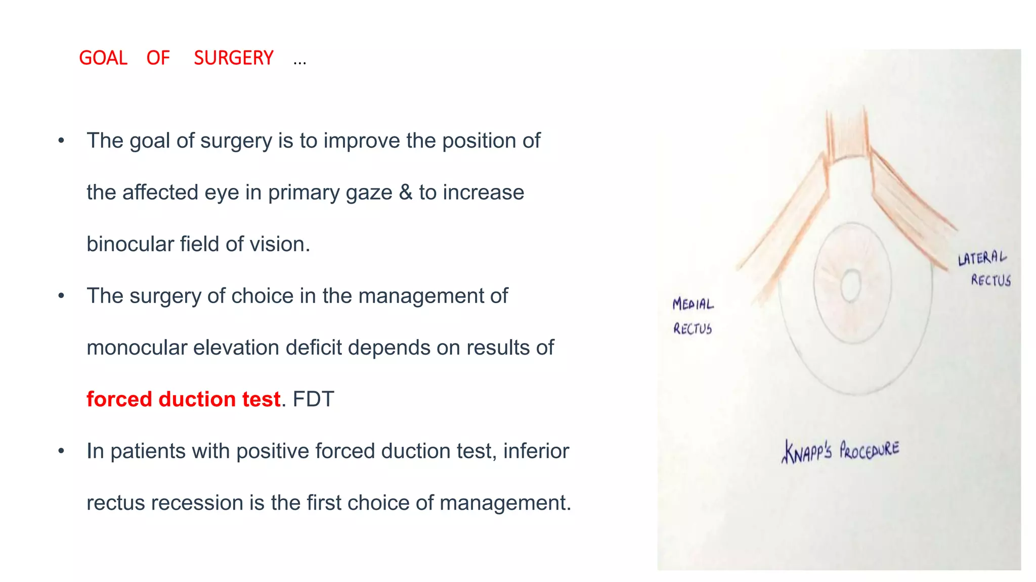 GOAL OF SURGERY …
• The goal of surgery is to improve the position of
the affected eye in primary gaze & to increase
binocular field of vision.
• The surgery of choice in the management of
monocular elevation deficit depends on results of
forced duction test. FDT
• In patients with positive forced duction test, inferior
rectus recession is the first choice of management.
 