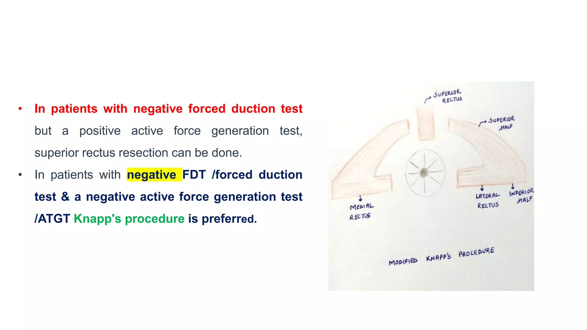 • In patients with negative forced duction test
but a positive active force generation test,
superior rectus resection can be done.
• In patients with negative FDT /forced duction
test & a negative active force generation test
/ATGT Knapp's procedure is preferred.
 