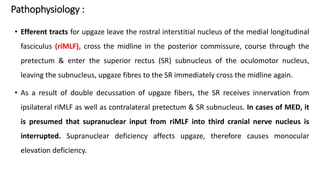 Pathophysiology :
• Efferent tracts for upgaze leave the rostral interstitial nucleus of the medial longitudinal
fasciculus (riMLF), cross the midline in the posterior commissure, course through the
pretectum & enter the superior rectus (SR) subnucleus of the oculomotor nucleus,
leaving the subnucleus, upgaze fibres to the SR immediately cross the midline again.
• As a result of double decussation of upgaze fibers, the SR receives innervation from
ipsilateral riMLF as well as contralateral pretectum & SR subnucleus. In cases of MED, it
is presumed that supranuclear input from riMLF into third cranial nerve nucleus is
interrupted. Supranuclear deficiency affects upgaze, therefore causes monocular
elevation deficiency.
 
