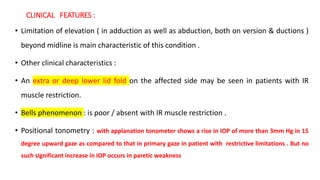 CLINICAL FEATURES :
• Limitation of elevation ( in adduction as well as abduction, both on version & ductions )
beyond midline is main characteristic of this condition .
• Other clinical characteristics :
• An extra or deep lower lid fold on the affected side may be seen in patients with IR
muscle restriction.
• Bells phenomenon : is poor / absent with IR muscle restriction .
• Positional tonometry : with applanation tonometer shows a rise in IOP of more than 3mm Hg in 15
degree upward gaze as compared to that in primary gaze in patient with restrictive limitations . But no
such significant increase in IOP occurs in paretic weakness
 