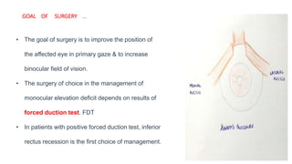 GOAL OF SURGERY …
• The goal of surgery is to improve the position of
the affected eye in primary gaze & to increase
binocular field of vision.
• The surgery of choice in the management of
monocular elevation deficit depends on results of
forced duction test. FDT
• In patients with positive forced duction test, inferior
rectus recession is the first choice of management.
 