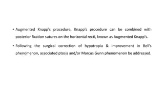 • Augmented Knapp's procedure, Knapp's procedure can be combined with
posterior fixation sutures on the horizontal recti, known as Augmented Knapp's.
• Following the surgical correction of hypotropia & improvement in Bell’s
phenomenon, associated ptosis and/or Marcus Gunn phenomenon be addressed.
 