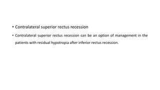 • Contralateral superior rectus recession
• Contralateral superior rectus recession can be an option of management in the
patients with residual hypotropia after inferior rectus recession.
 