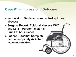 16
Case #1 – Impression / Outcome
 Impression: Bacteremia and spinal epidural
abscess.
 Surgical Report: Epidural abscess C6-7
and L5-S1. Purulent material
found at both places.
 Patient Outcome: Complete
permanent paralysis in her
lower extremities.
 