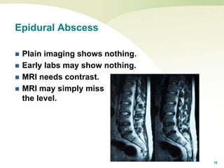 18
Epidural Abscess
 Plain imaging shows nothing.
 Early labs may show nothing.
 MRI needs contrast.
 MRI may simply miss
the level.
 