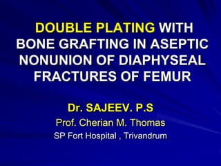 DOUBLE PLATING WITH
BONE GRAFTING IN ASEPTIC
NONUNION OF DIAPHYSEAL
FRACTURES OF FEMUR
Dr. SAJEEV. P.S
Prof. Cherian M. Thomas
SP Fort Hospital , Trivandrum
 