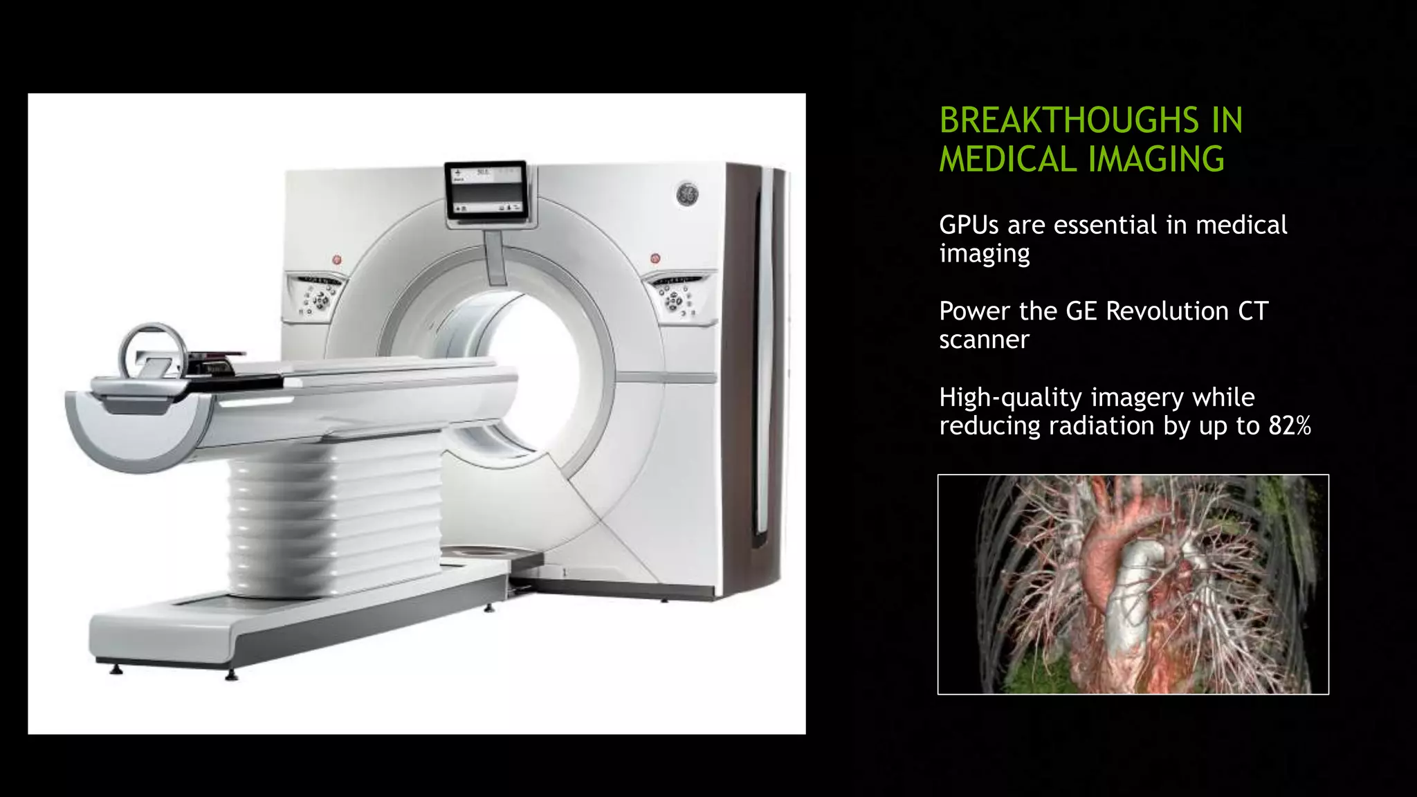 BREAKTHOUGHS IN
MEDICAL IMAGING
GPUs are essential in medical
imaging
Power the GE Revolution CT
scanner
High-quality imagery while
reducing radiation by up to 82%
 