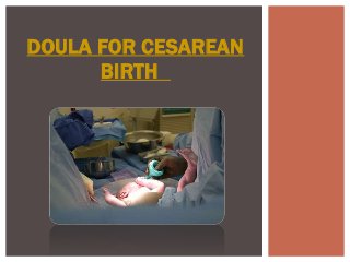 DOULA FOR CESAREAN
BIRTH
 