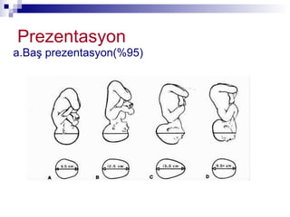 Prezentasyon a.Baş prezentasyon(%95)  