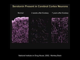 National Institute on Drug Abuse, 2002; Monkey Brain
 