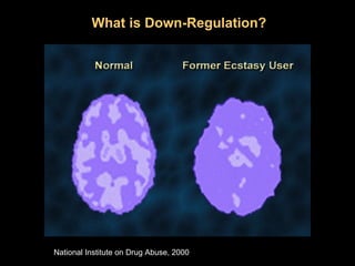 What is Down-Regulation?




National Institute on Drug Abuse, 2000
 