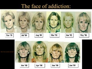 The face of addiction:




http://www.youtube.com/watch?v=02ngAsHRg4A
 
