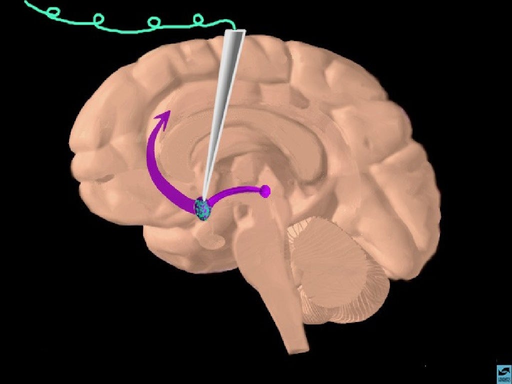 Down regulation and addictionmost updated