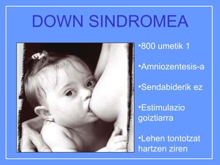 DOWN SINDROMEA ,[object Object],[object Object],[object Object],[object Object],[object Object]