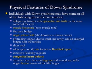 Physical Features of Down Syndrome <ul><li>Individuals with Down syndrome may have some or all of the following physical c...