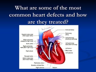 What are some of the most common heart defects and how are they treated? 