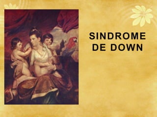 SINDROME
DE DOWN
 