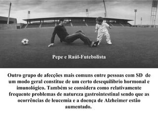Pepe e Raúl-Futebolista Outro grupo de afecções mais comuns entre pessoas com SD  de um modo geral constitue de um certo desequilíbrio hormonal e imunológico. Também se considera como relativamente frequente problemas de natureza gastrointestinal sendo que as ocorrências de leucemía e a doença de Alzheimer estão aumentado.   